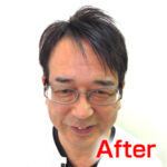 katura-after1