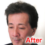 katura-after3