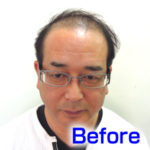 katura-before1