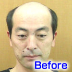 katura-before2
