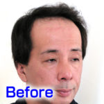 katura-before3