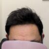 スキンベースを痛ませないテープの貼り方。（動）